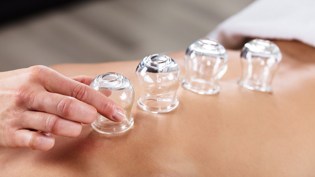 Cupping Massage Therapy